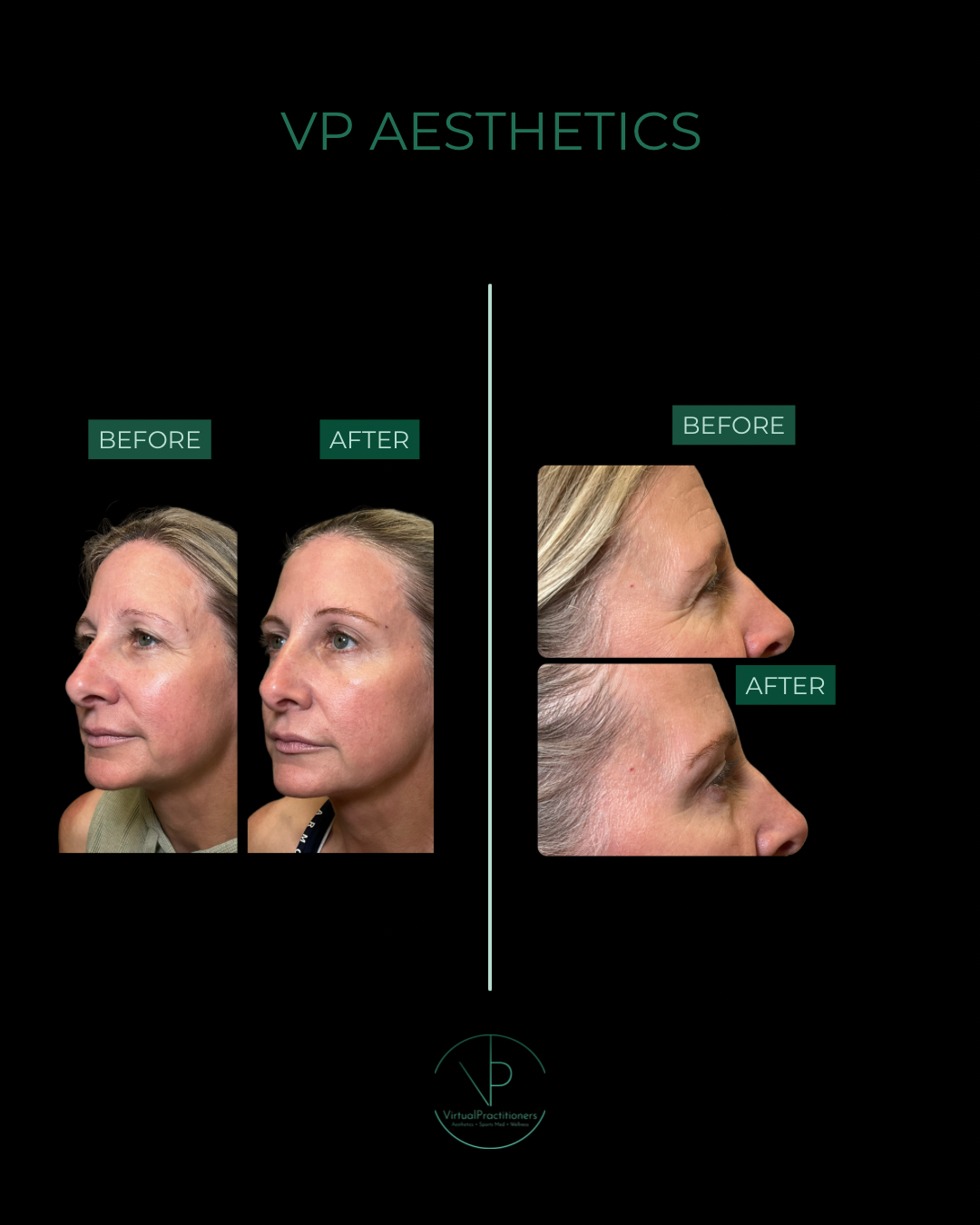VP AESTHETICS - 1
