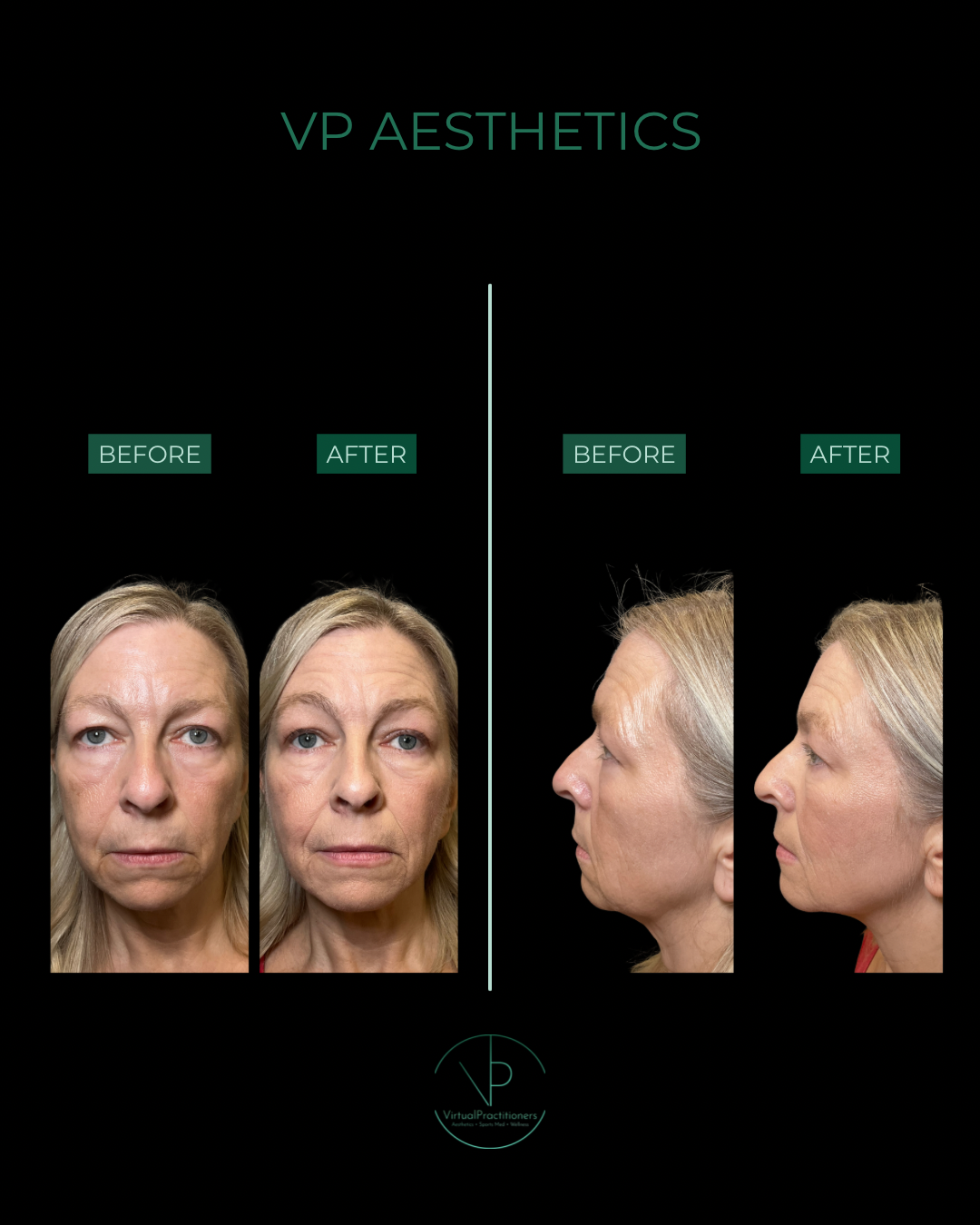 VP AESTHETICS - 2