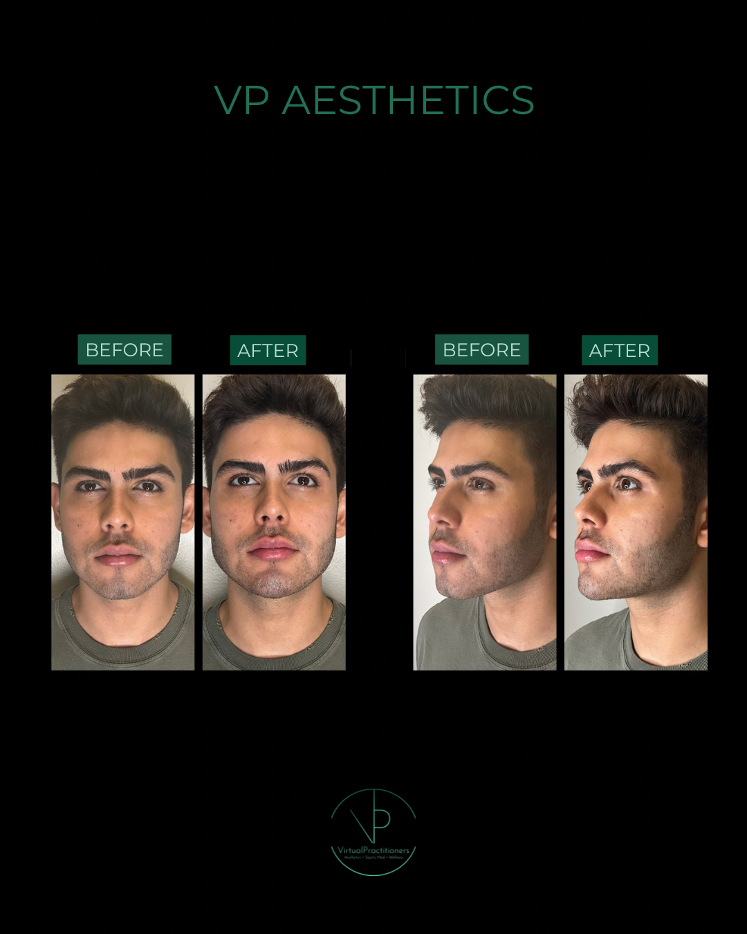 VP AESTHETICS 2