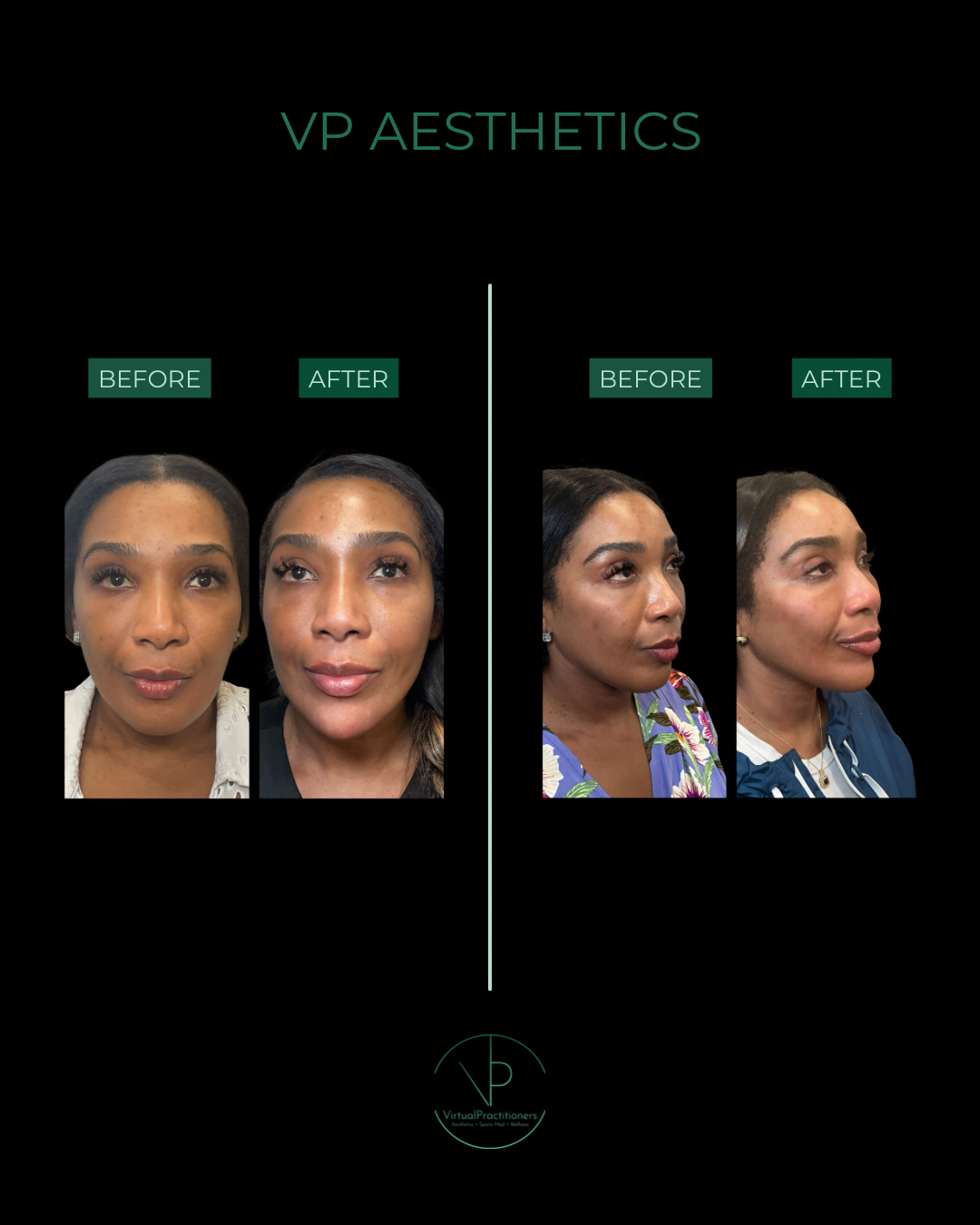VP AESTHETICS - 3