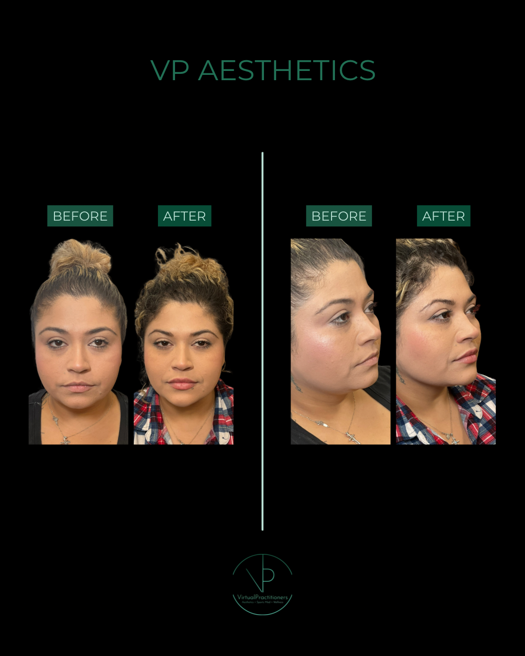 VP AESTHETICS - 4